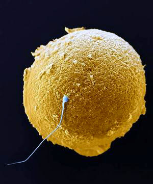 egg-and-sperm