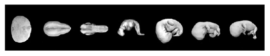 Stages of development of a fetus